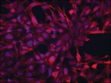 Anti-JUB (N-terminal) antibody produced in rabbit ~1.5 mg/mL, affinity isolated antibody, buffered aqueous solution