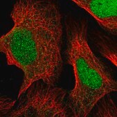 Anti-FARSB antibody produced in rabbit Prestige Antibodies&#174; Powered by Atlas Antibodies, affinity isolated antibody, buffered aqueous glycerol solution