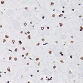 Anti-Acetyl-Histone H3-K18 antibody produced in rabbit
