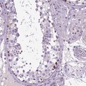 Anti-PLK5 antibody produced in rabbit Prestige Antibodies&#174; Powered by Atlas Antibodies, affinity isolated antibody, buffered aqueous glycerol solution