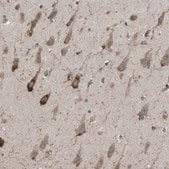 Anti-AIMP1 antibody produced in rabbit Prestige Antibodies&#174; Powered by Atlas Antibodies, affinity isolated antibody, buffered aqueous glycerol solution