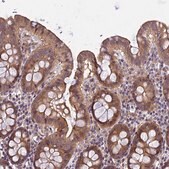 Anti-FAM98C antibody produced in rabbit Prestige Antibodies&#174; Powered by Atlas Antibodies, affinity isolated antibody, buffered aqueous glycerol solution