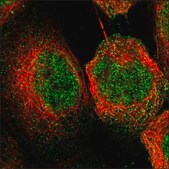 Anti-OSGIN1 antibody produced in rabbit Prestige Antibodies® Powered by Atlas Antibodies, affinity isolated antibody, buffered aqueous glycerol solution