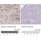 Anti-CCSAP antibody produced in rabbit Prestige Antibodies&#174; Powered by Atlas Antibodies, affinity isolated antibody, buffered aqueous glycerol solution