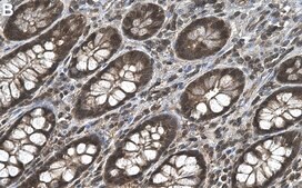 Anti-MKK3/MKK6 Antibody, clone 2E21 ZooMAb® Rabbit Monoclonal recombinant, expressed in HEK 293 cells