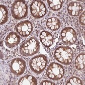 Anti-FIGNL1 antibody produced in rabbit Prestige Antibodies&#174; Powered by Atlas Antibodies, affinity isolated antibody, buffered aqueous glycerol solution