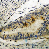Anti-phospho-Dab1 (pTyr232) antibody produced in rabbit affinity isolated antibody