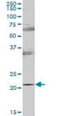 Anti-RAB31 antibody produced in mouse purified immunoglobulin, buffered aqueous solution