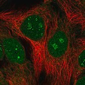 Anti-SIMC1 antibody produced in rabbit Prestige Antibodies&#174; Powered by Atlas Antibodies, affinity isolated antibody