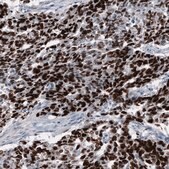 Monoclonal Anti-SALL4 antibody produced in mouse Prestige Antibodies&#174; Powered by Atlas Antibodies, clone CL12180, purified immunoglobulin, buffered aqueous glycerol solution