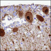 Anti-KDM5D antibody produced in rabbit Prestige Antibodies® Powered by Atlas Antibodies, affinity isolated antibody, buffered aqueous glycerol solution