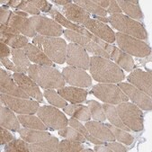Anti-CCM2 antibody produced in rabbit Prestige Antibodies&#174; Powered by Atlas Antibodies, affinity isolated antibody, buffered aqueous glycerol solution, Ab2