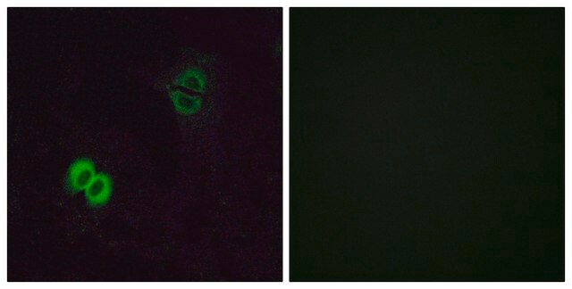 Anti-OR2T1 antibody produced in rabbit affinity isolated antibody