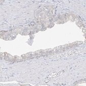 Anti-DCDC2 antibody produced in rabbit Prestige Antibodies&#174; Powered by Atlas Antibodies, affinity isolated antibody, buffered aqueous glycerol solution