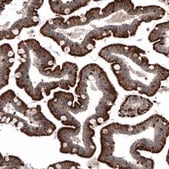 Monoclonal Anti-LAMP1 antibody produced in mouse Prestige Antibodies&#174; Powered by Atlas Antibodies, clone CL4472, purified immunoglobulin