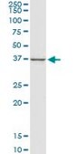 Monoclonal Anti-CTGF antibody produced in mouse clone 2C11, purified immunoglobulin, buffered aqueous solution
