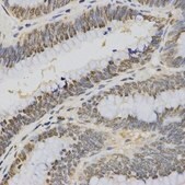 Anti-TriMethyl-Histone H3-K4 antibody produced in rabbit