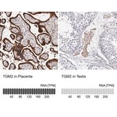 Anti-TGM2 antibody produced in rabbit Prestige Antibodies&#174; Powered by Atlas Antibodies, affinity isolated antibody, buffered aqueous glycerol solution