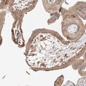 Anti-AP1AR antibody produced in rabbit Prestige Antibodies&#174; Powered by Atlas Antibodies, affinity isolated antibody, buffered aqueous glycerol solution