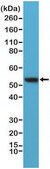 Anti-Vimentin antibody, Rabbit Monoclonal recombinant, expressed in HEK 293 cells, clone RM289, purified immunoglobulin