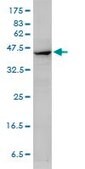 Monoclonal Anti-ACTA2 antibody produced in mouse clone 4A8-2H3, purified immunoglobulin, buffered aqueous solution