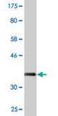 Monoclonal Anti-KLHL1 antibody produced in mouse clone 3C2, purified immunoglobulin, buffered aqueous solution