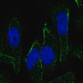 Anti-MEX3C antibody produced in rabbit Prestige Antibodies&#174; Powered by Atlas Antibodies, affinity isolated antibody, buffered aqueous glycerol solution