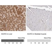Anti-ACAT2 antibody produced in rabbit Prestige Antibodies&#174; Powered by Atlas Antibodies, affinity isolated antibody, buffered aqueous glycerol solution, Ab3