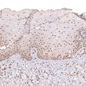 Monoclonal Anti-Prrx1 Antibody Produced In Mouse Prestige Antibodies&#174; Powered by Atlas Antibodies, clone CL14471, affinity isolated antibody, buffered aqueous glycerol solution