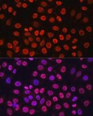 Anti-Pan DiMethyl-lysine antibody produced in rabbit
