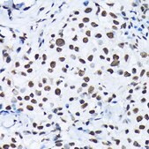 Anti-Phospho-c-Jun-S63 antibody produced in rabbit
