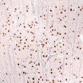 Monoclonal Anti-Foxo3 Antibody Produced In Mouse Prestige Antibodies® Powered by Atlas Antibodies, clone CL13589, affinity isolated antibody, buffered aqueous glycerol solution