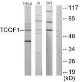 Anti-TCOF1, N-Terminal antibody produced in rabbit affinity isolated antibody