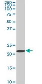 Monoclonal Anti-RPS7 antibody produced in mouse clone 3G4, purified immunoglobulin, buffered aqueous solution