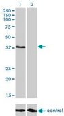 Monoclonal Anti-RNF14 antibody produced in mouse clone 4G9, purified immunoglobulin, buffered aqueous solution