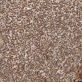 Anti-RNF122 antibody produced in rabbit Prestige Antibodies&#174; Powered by Atlas Antibodies, affinity isolated antibody, buffered aqueous glycerol solution