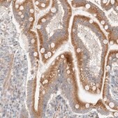 Anti-RRP15 antibody produced in rabbit Prestige Antibodies&#174; Powered by Atlas Antibodies, affinity isolated antibody, buffered aqueous glycerol solution