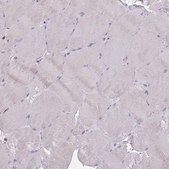 Anti-CENPM antibody produced in rabbit Prestige Antibodies® Powered by Atlas Antibodies, affinity isolated antibody, buffered aqueous glycerol solution