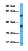 Anti-SLC38A2, (N-terminal) antibody produced in rabbit affinity isolated antibody