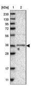 Anti-TRMO antibody produced in rabbit Prestige Antibodies&#174; Powered by Atlas Antibodies, affinity isolated antibody, buffered aqueous glycerol solution