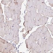 Anti-MYL7 antibody produced in rabbit Prestige Antibodies&#174; Powered by Atlas Antibodies, affinity isolated antibody, buffered aqueous glycerol solution