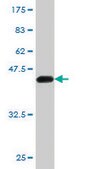 Monoclonal Anti-KRAS antibody produced in mouse clone 3B10-2F2, purified immunoglobulin, buffered aqueous solution