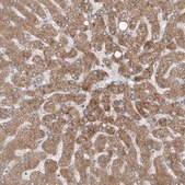 Anti-CYP4V2 antibody produced in rabbit Prestige Antibodies® Powered by Atlas Antibodies, affinity isolated antibody, buffered aqueous glycerol solution