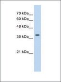 Anti-TPM1 antibody produced in rabbit IgG fraction of antiserum
