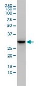 Monoclonal Anti-MASA antibody produced in mouse clone 3C1-1D5, purified immunoglobulin, buffered aqueous solution