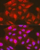 Anti-Phospho-PDPK1-S241 antibody produced in rabbit