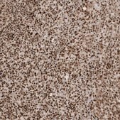 Anti-CKS2 antibody produced in rabbit Prestige Antibodies&#174; Powered by Atlas Antibodies, affinity isolated antibody, buffered aqueous glycerol solution