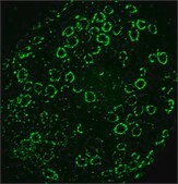 Anti-col1a1a antibody produced in rabbit affinity isolated antibody, buffered aqueous solution