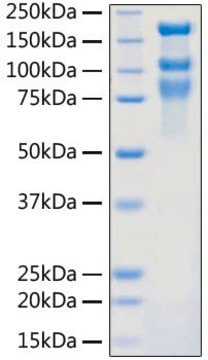 Recombinant 2019-nCoV S1+S2 ECD (S-ECD) Protein with His tag