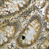 Anti-phospho-c-Jun (pThr93) antibody produced in rabbit affinity isolated antibody